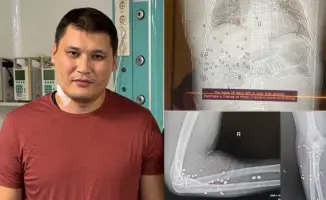 Шымкент: Заместителя акима Руслана Берденова готовят к повторной операции после покушения