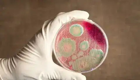 Байсерк: сибирская язва не угрожает жителям