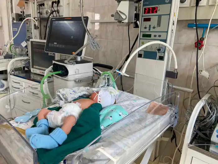 В Алматы успешно выхаживают недоношенного младенца весом 742 грамма благодаря современным медицинским технологиям