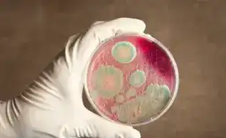 Байсерк: сибирская язва не угрожает жителям