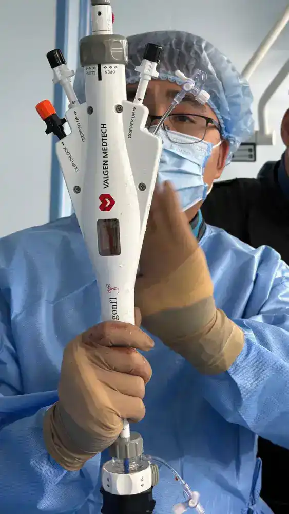 Успешное восстановление функций митрального клапана у пациента высокого хирургического риска в НИИКВБ с использованием системы DragonFly