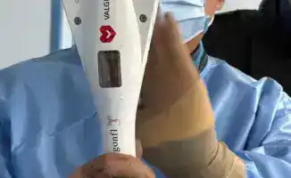 Успешное восстановление функций митрального клапана у пациента высокого хирургического риска в НИИКВБ с использованием системы DragonFly