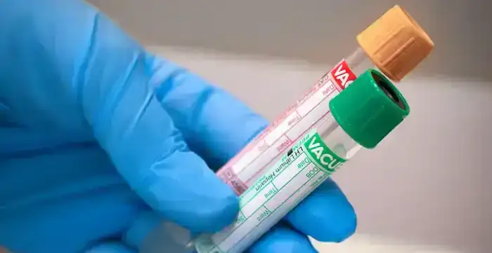 Расследование: Компания INVIVO Business подозревается в злоупотреблении доминирующим положением на рынке лабораторных услуг