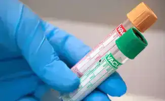 Расследование: Компания INVIVO Business подозревается в злоупотреблении доминирующим положением на рынке лабораторных услуг