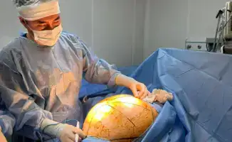 Успешное удаление 25-килограммовой опухоли в Алматы: влияние на здоровье пациентки и её дальнейшую реабилитацию