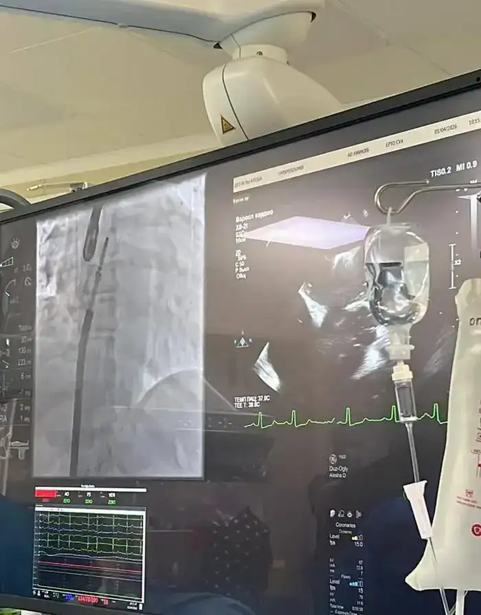 В НИИ КАРДИОЛОГИИ И ВНУТРЕННИХ БОЛЕЗНЕЙ ПРОВЕДЕНЫ УНИКАЛЬНЫЕ ОПЕРАЦИИ ПО ТЕХНОЛОГИИ TEER (2)