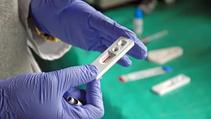 В Казахстане введут обязательное медицинское освидетельствование на употребление наркотиков и психотропных веществ для части госслужащих, что может привести к раскрытию случаев коррупции и злоупотреблений среди чиновников.