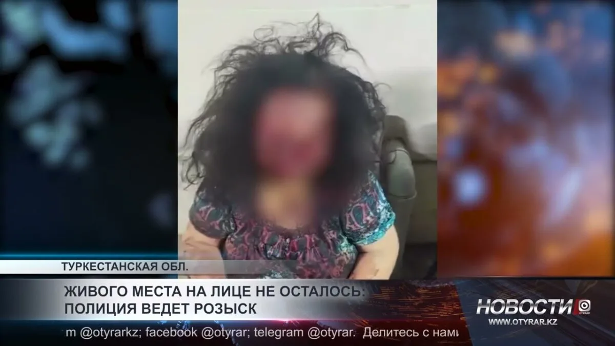 Полиция ищет человека с 'лицом без живого места'